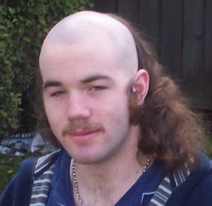 A photo of the Skullet haircut, a variation of...