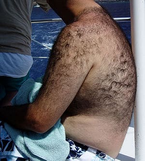 Androgenic body hair, photograph taken on Maui...